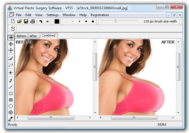 Virtual Plastic Surgery Software